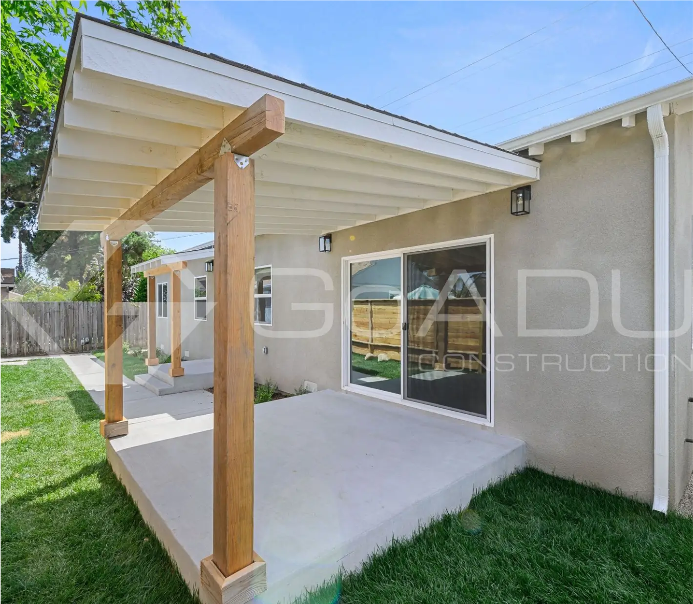Adu setbacks in the city of los angeles
